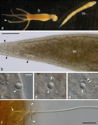  Eyepharyngeal  This free-living flatworm exhibits mesmerizing regenerative abilities and an insatiable appetite for microscopic prey!