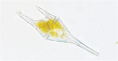  Peridinium: Un Flagellato che Scintilla sotto il Sole Estivo! 